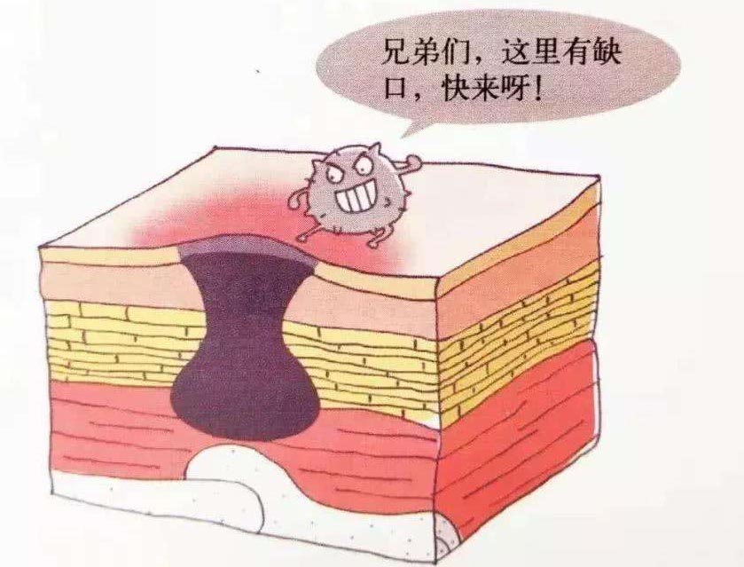 【科普】压疮(褥疮)重在预防,请记住这些做法!
