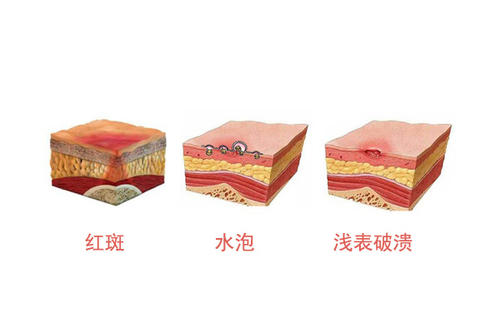 촯Ĳʲô֢״