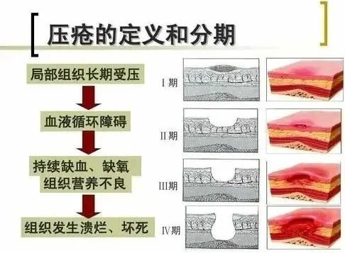 촯ٴѡʺϵķϺҪ