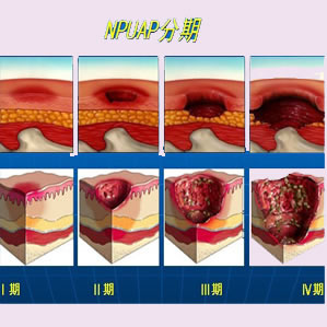 촯ķڼʱڵĻ