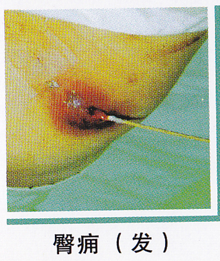 ŧԼ-Ӹ5